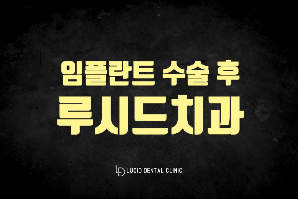 강남구청역 치과 임플란트 수술 후 부작용 예방할 수 있는 행동 수칙은 무엇이 있을까요? 관련 이미지 4
