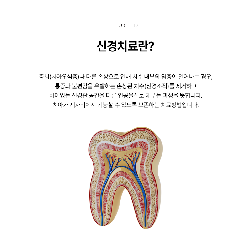 If You’re About to Receive Root Canal Treatment at Seonjeongneung Station Dental Clinic image 2
