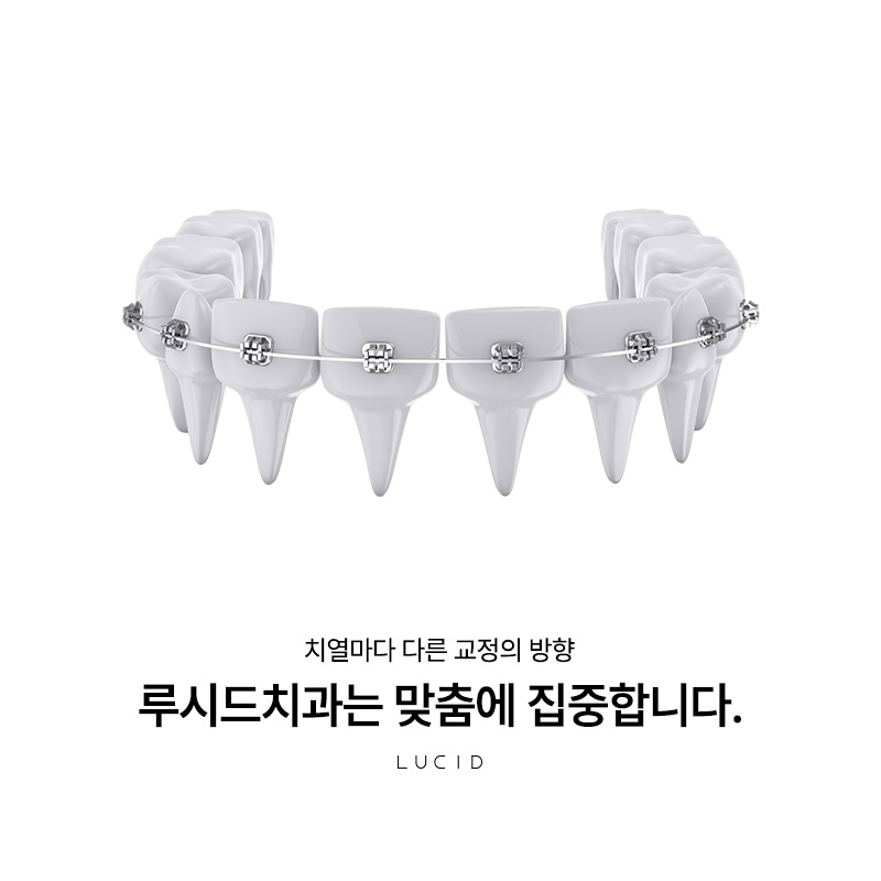 강남치과 치아 배열이 고민일 때 관련 이미지 1