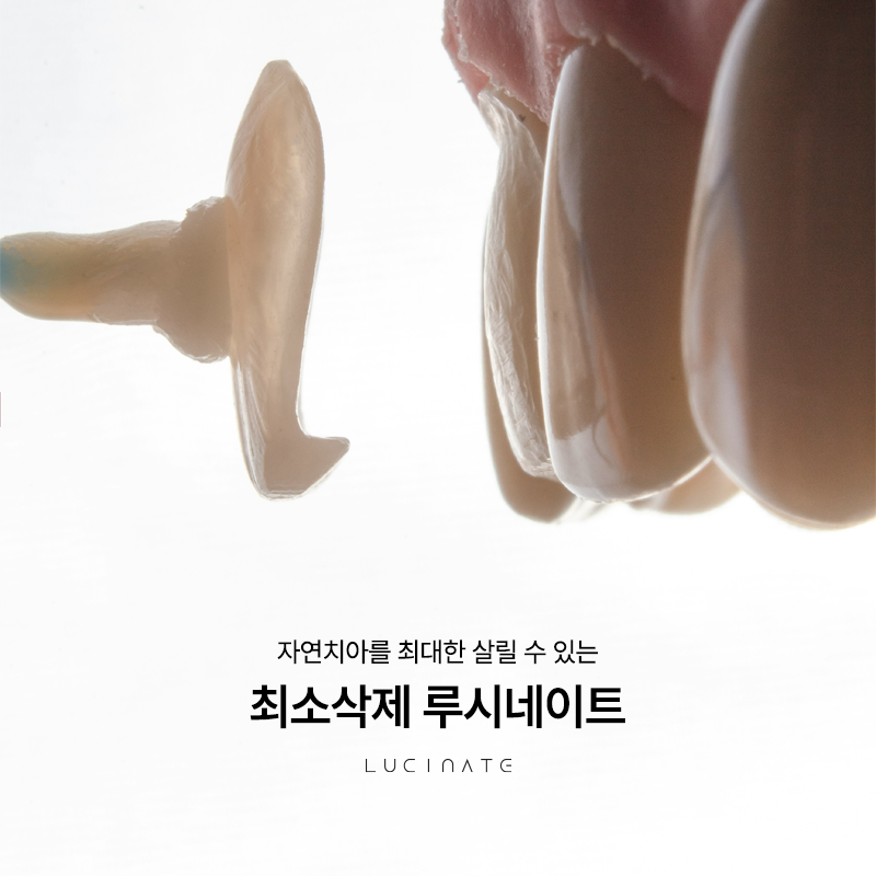 When Is Laminates Treatment Needed at Yeoksam Station Dental Clinic? image 2