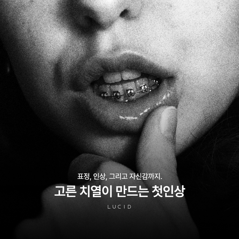 Orthodontic Treatment: Are You Still Hesitating? image 2