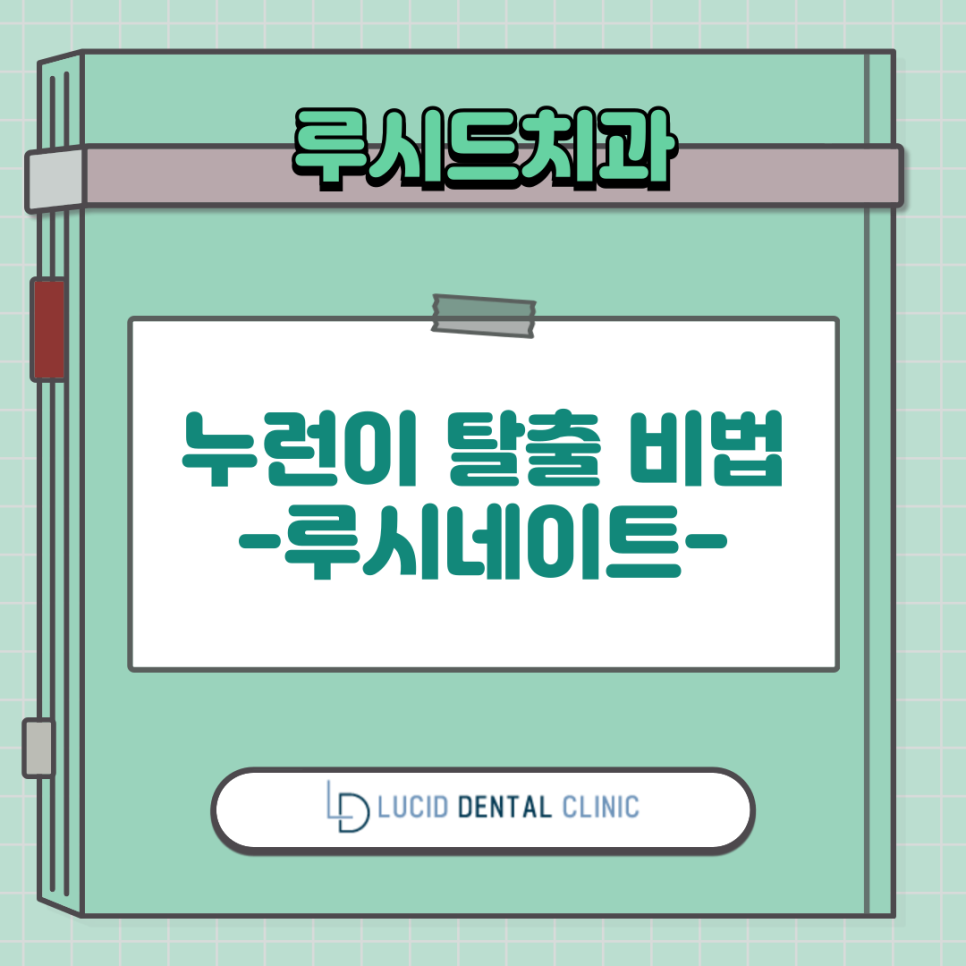 누런이 탈출 비법, 역삼동 치과 에서 자세히 알려드리겠습니다. ft. 루시네이트 관련 이미지 13
