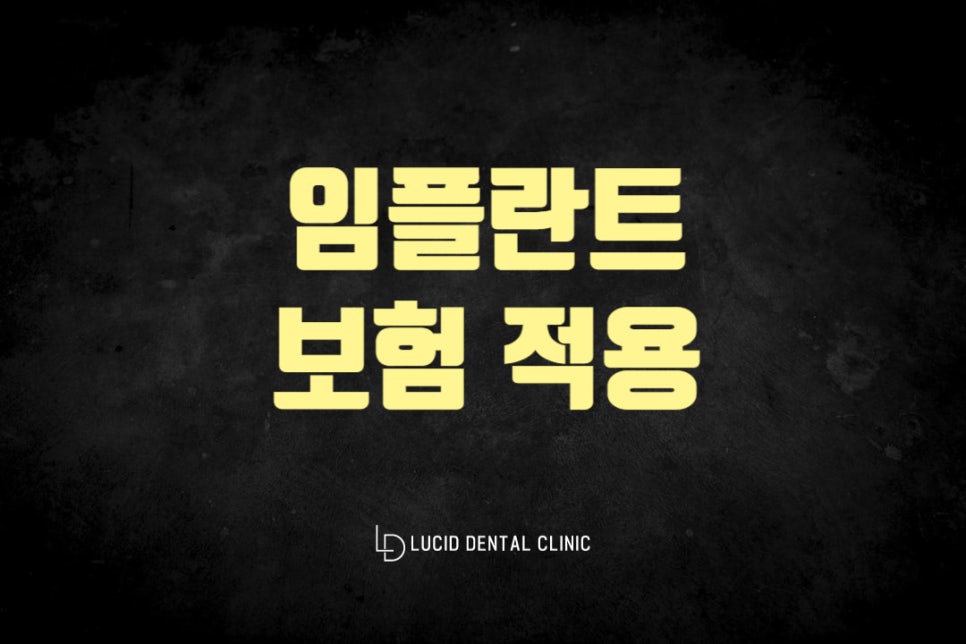 논현동 치과 임플란트 보험 적용 받아서 좀 더 부담덜고 심어볼까요? 관련 이미지 1