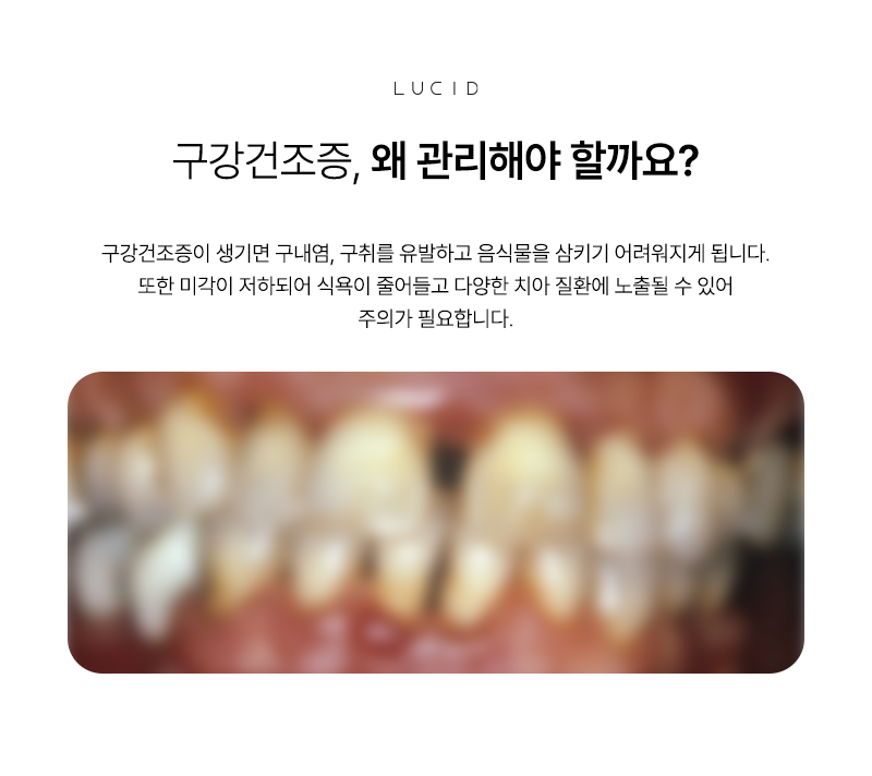 If Your Mouth Keeps Getting Dry, Is It a Sign of Dry Mouth Syndrome? image 4