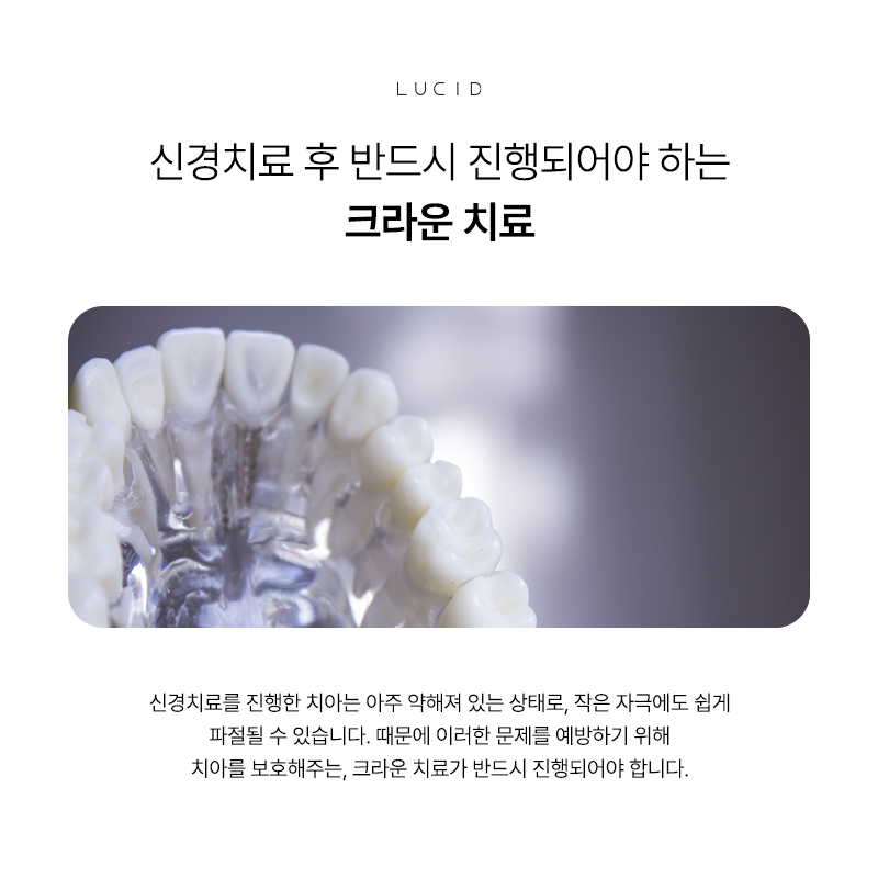 If You’re About to Receive Root Canal Treatment at Seonjeongneung Station Dental Clinic image 5