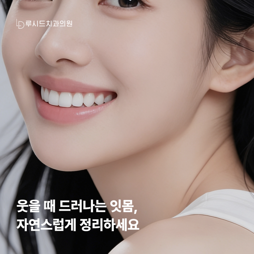 신논현역치과 짧아 보이는 치아가 고민이라면 관련 이미지 1