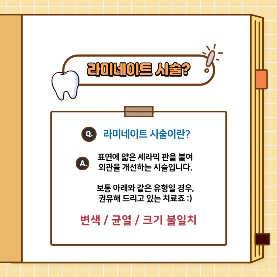 앞니 라미네이트 란? 과정 및 방법, 여기에 주의 사항까지 강남역 치과 에서 모두 알려드리겠습니다! 관련 이미지 2