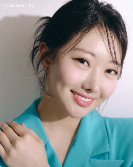 선정릉역 치과 라미네이트 시술 잘하는곳은 이렇게 진행합니다. (ft. 전후 비교 및 주의 사항 소개) 관련 이미지 5