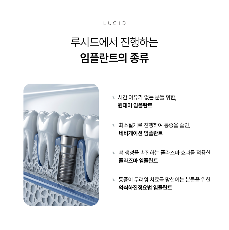 Instead of Uncomfortable Dentures, Natural-looking Lucid Implants image 3