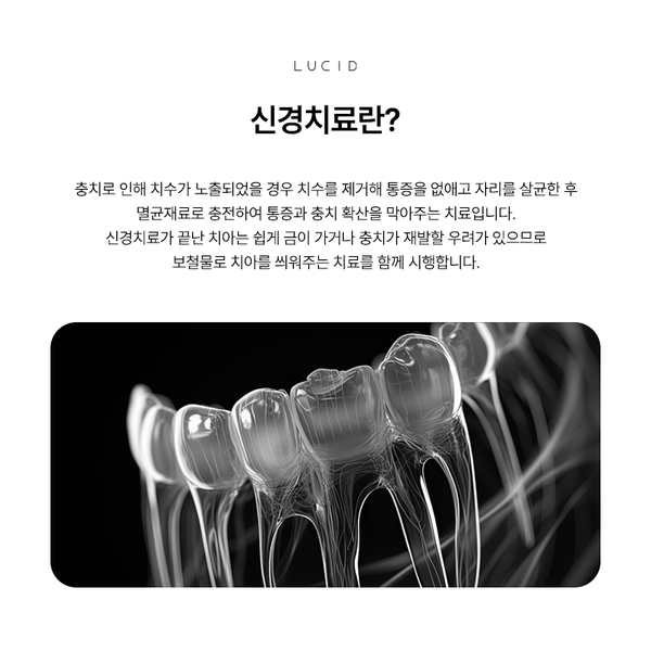 논현동치과 신경치료 미루면 생기는 문제와 주의사항 관련 이미지 2