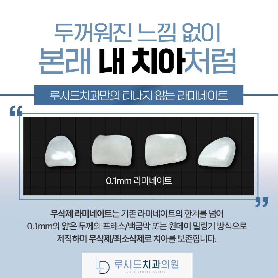 앞니 치아 살짝 깨짐 으로 인한 신논현역 치과 내원, 통증 없어 망설이고 계신가요? 관련 이미지 2