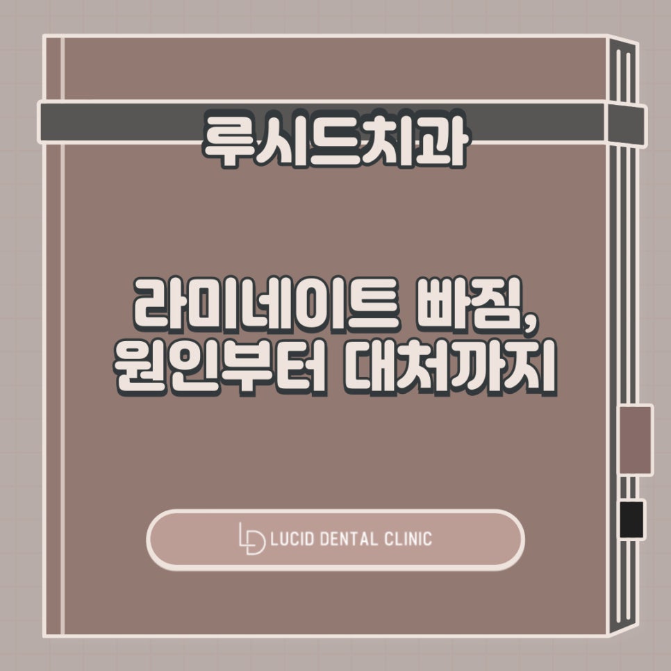 라미네이트 빠짐 의 원인 및 부작용, 대처 방법까지 역삼역 치과 가 알려드리겠습니다. 관련 이미지 12