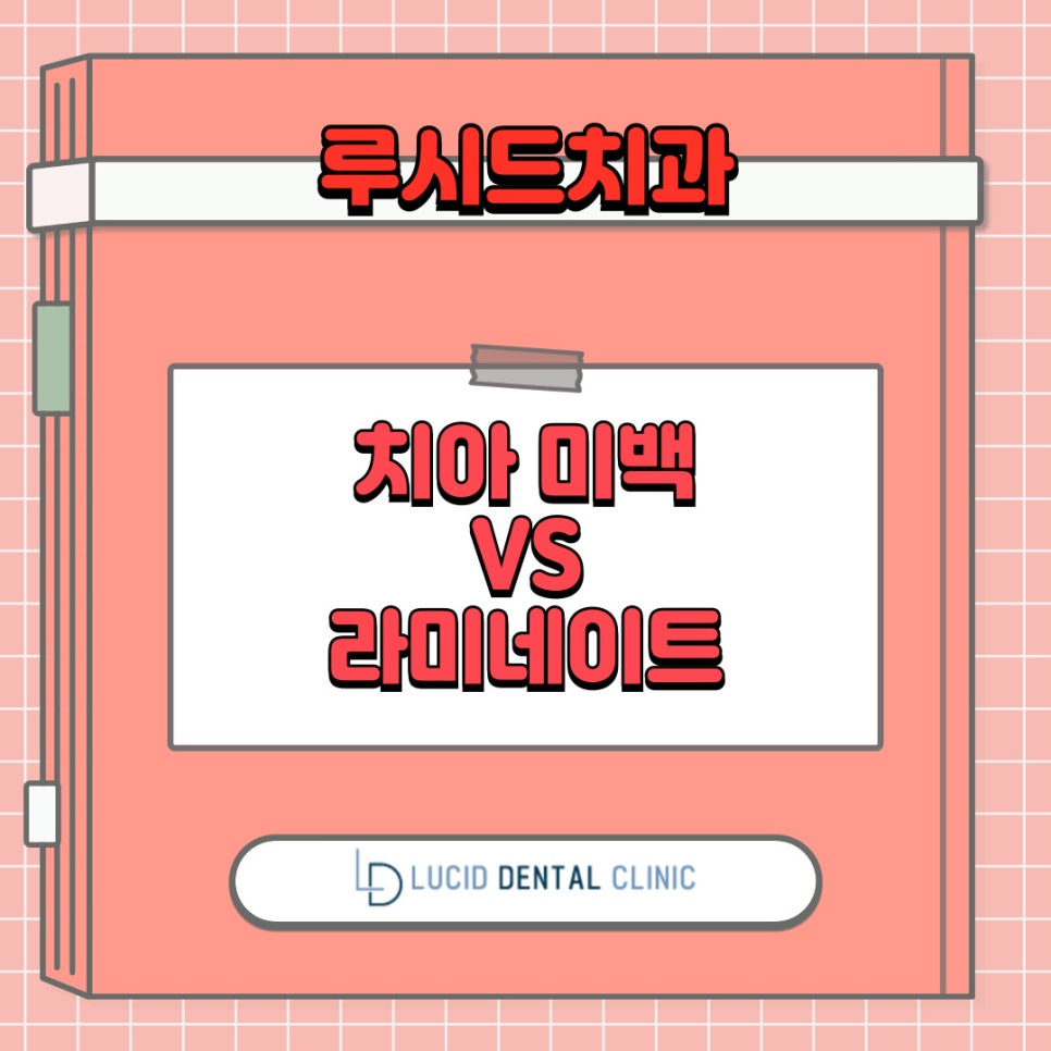 내 치아는 미백 VS 라미네이트 어떤 걸 받아야 될까? - 서초동 치과 의 구강 상식 소개 관련 이미지 9