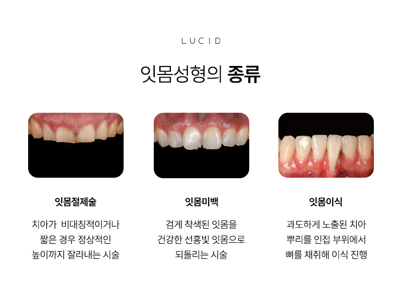 Seonjeongneung Station Dental Clinic: How to Create a Beautiful Smile image 3
