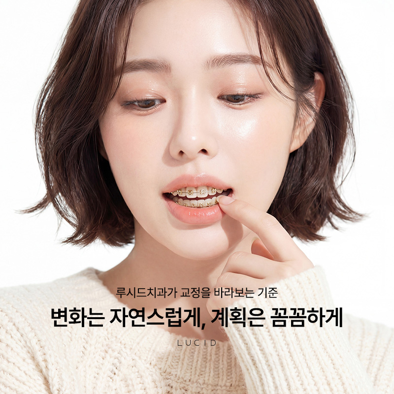 역삼동치과, 치아교정 어떤 점이 중요한지 살펴볼까요? 관련 이미지 1