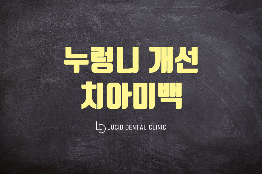 누렁니 때문에 스트레스라면? 논현동 치과 에서 치아미백 받자! 관련 이미지 1