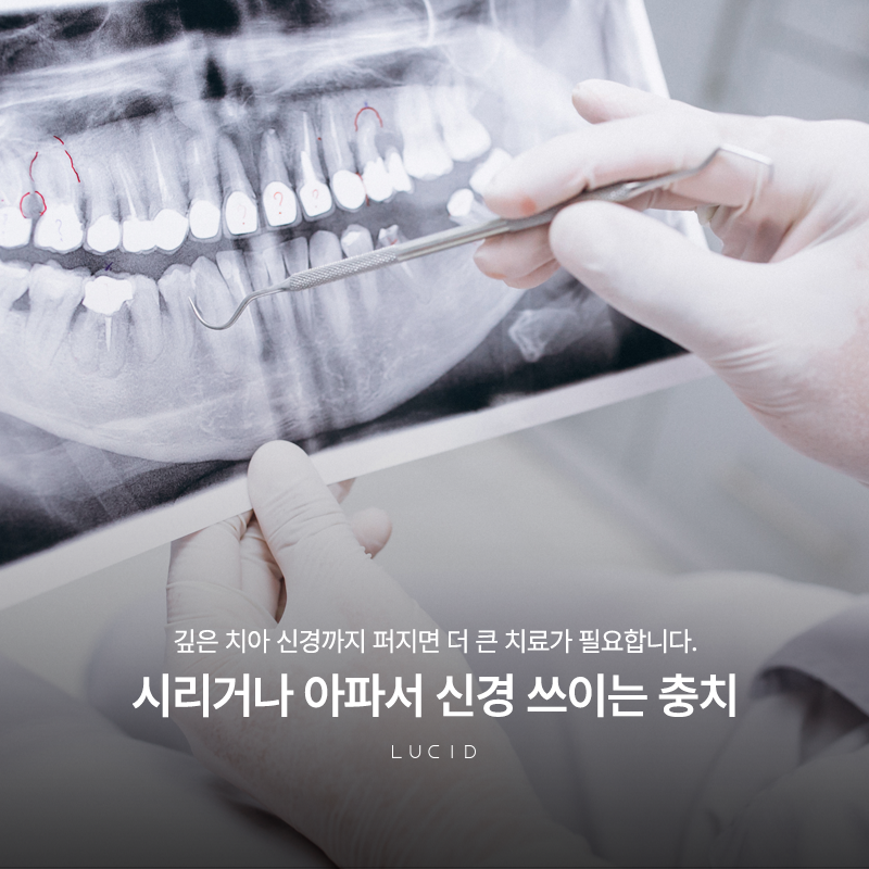 Gangnam Station Cavity Treatment Before the Problem Gets Worse image 1