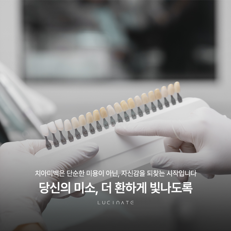 Gangnam Teeth Whitening: Where Should You Go to See Results? image 2
