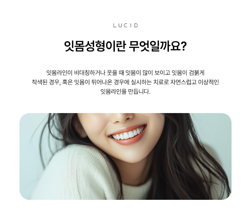 Seolleung Dental Clinic: Do Your Gums Show Too Much When You Smile? image 3