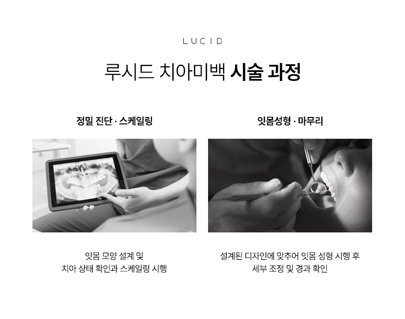 Seonjeongneung Station Dental Clinic: How to Create a Beautiful Smile image 6
