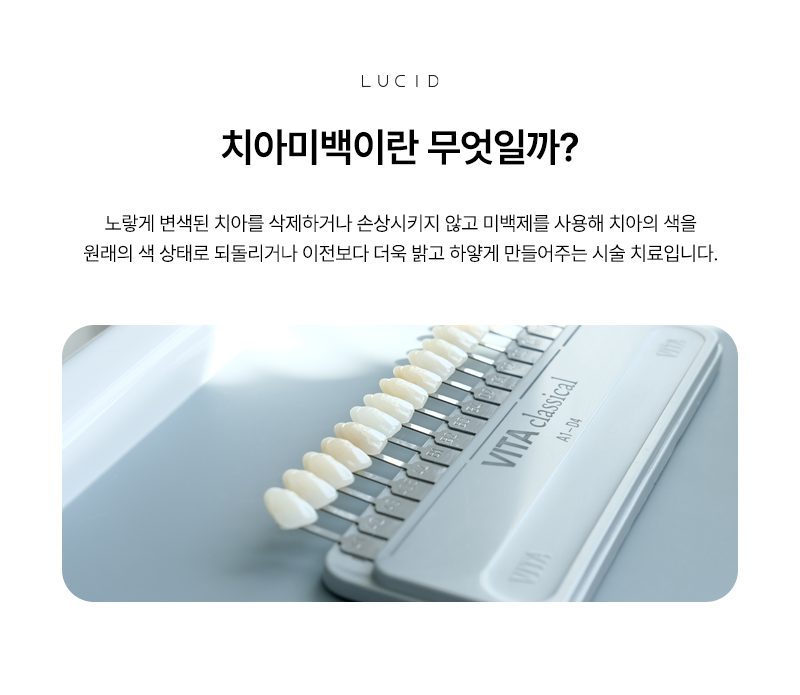 If You Have a Wedding or Interview Coming Up? Teeth Whitening at Nonhyeon Dental Clinic image 3