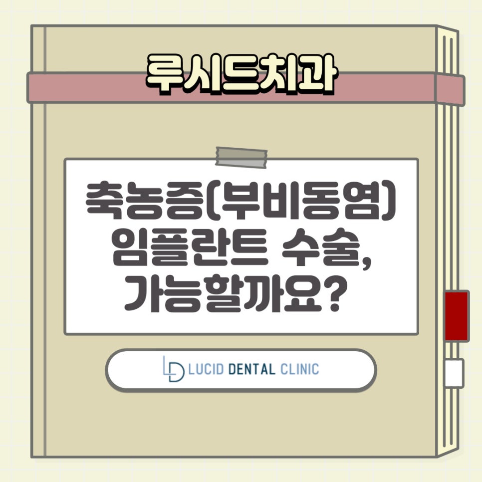 축농증(부비동염) 있는 상태에서 임플란트 식립이 가능할까요? 강남역 치과 가 자세히 알려드리겠습니다! 관련 이미지 3