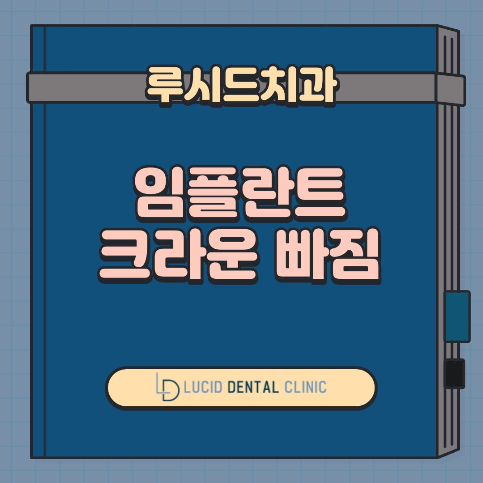 서초동 치과 임플란트 했는데 크라운 보철이 빠지면 어떻게 해야 될까요? 관련 이미지 1