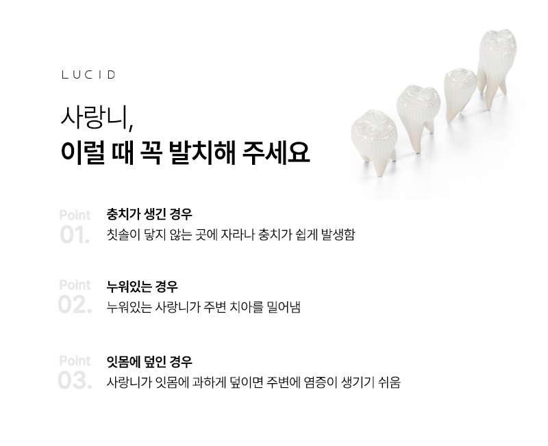 강남역 근처 치과 사랑니발치 후 운동 가능한 시점 관련 이미지 4