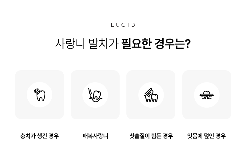 강남 사랑니발치전문치과 선택 전 꼭 확인하세요 관련 이미지 3