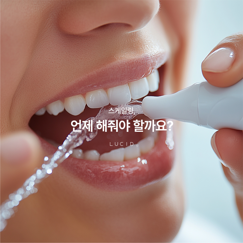 Everything About Scaling at Gangnam Station Dental Clinic image 2