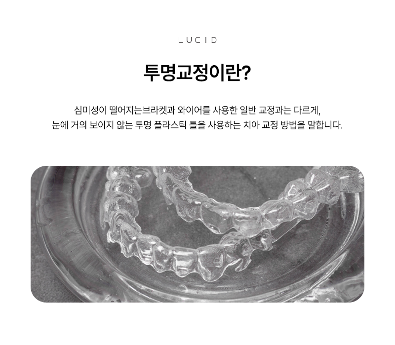 역삼역치과에서 투명교정, 누구에게 맞을까? 관련 이미지 3