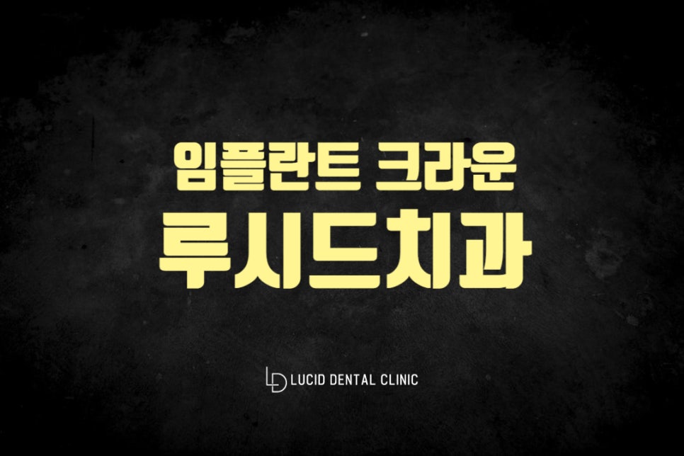 선정릉역 치과 임플란트 크라운 종류 나에게 맞는 것은 무엇일까? 관련 이미지 5