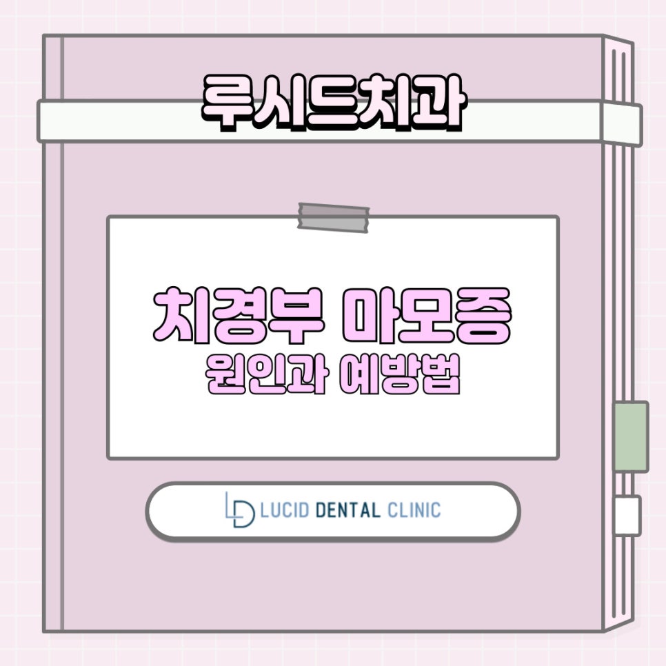 "어금니 치아가 시려요!" 치아 시림, 알고 보니 치경부 마모증? - 강남역 치과 추천 관련 이미지 1