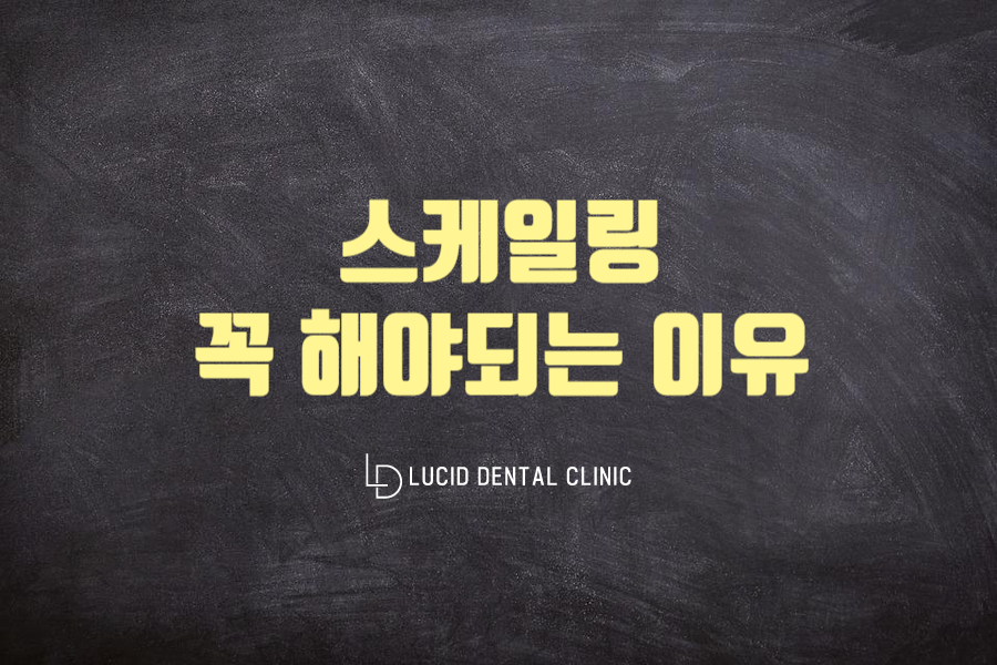 선정릉역 스케일링 꼭 받아야 되는 이유는? 루시드 치과 에서 알려드립니다 관련 이미지 1