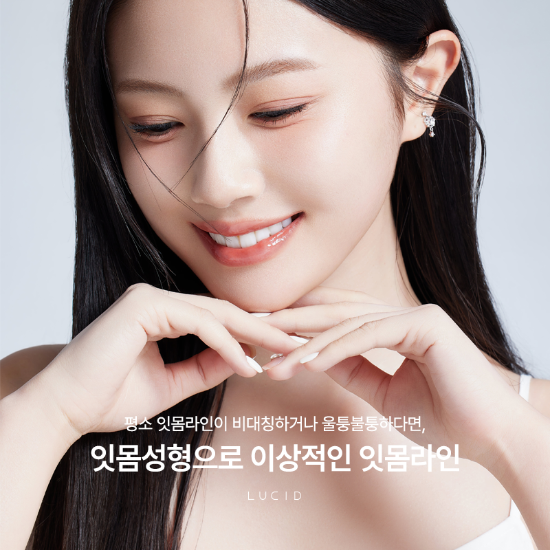 Seonjeongneung Station Dental Clinic: How to Create a Beautiful Smile image 2