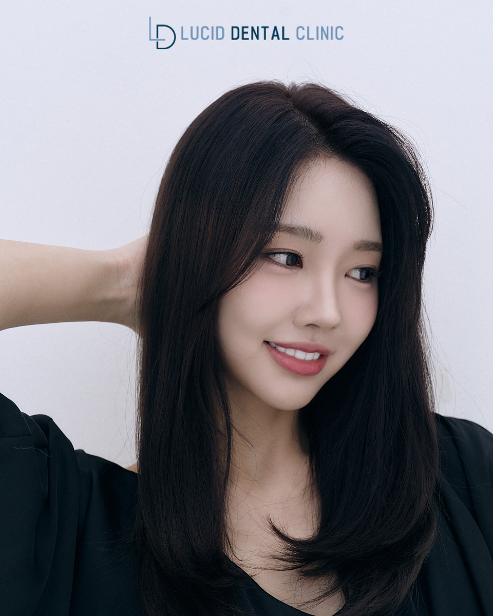 툭 튀어나온 앞니, 루시네이트로 예쁜 치아 만들기 논현동 치과 추천 관련 이미지 1