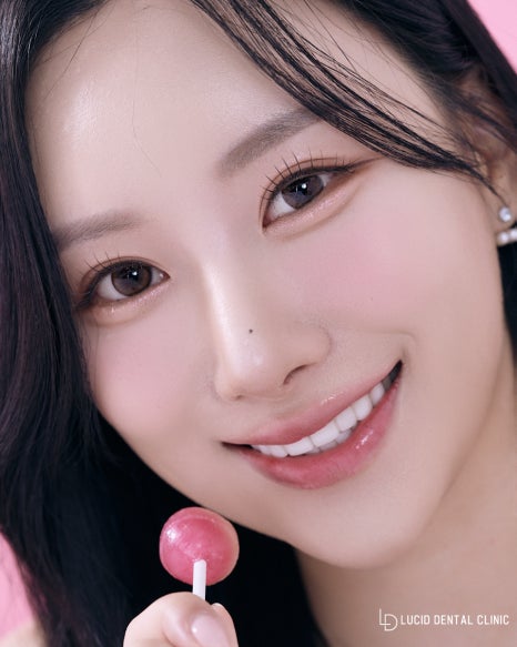 "앞니 치아 사이가 벌어져서 안 예뻐요!" 역삼동 치과 하루만에 예뻐지는 루시네이트 시술 후기 관련 이미지 1