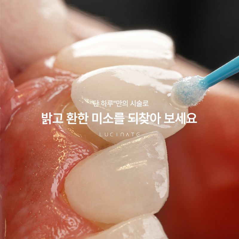 강남라미네이트 하루 만에 완성 가능한 방법 관련 이미지 1
