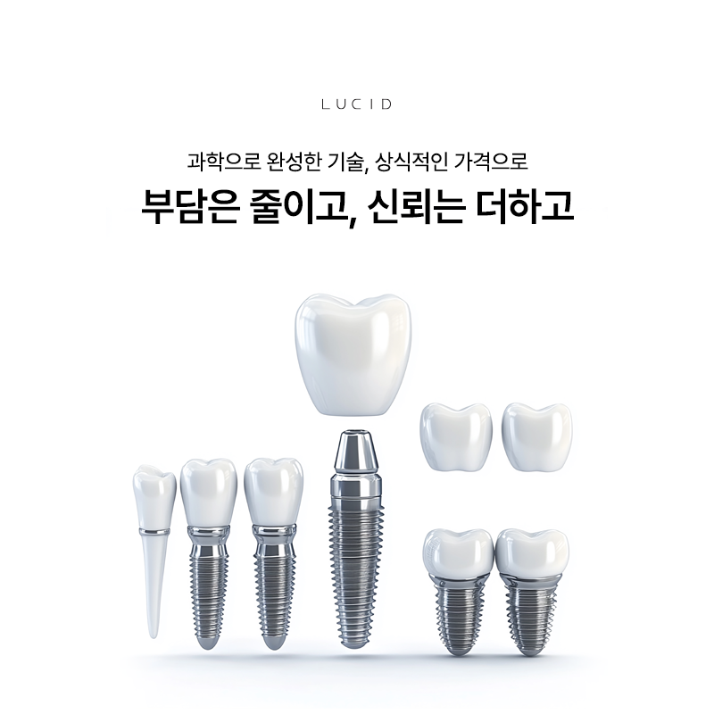 Resolving Your Questions About Implants image 2