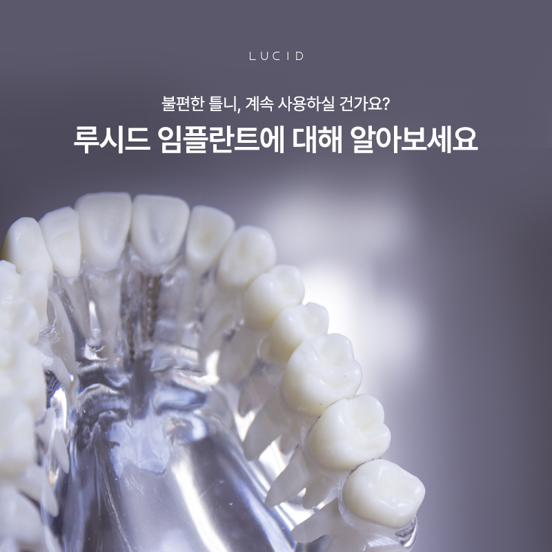 Instead of Uncomfortable Dentures, Natural-looking Lucid Implants image 2