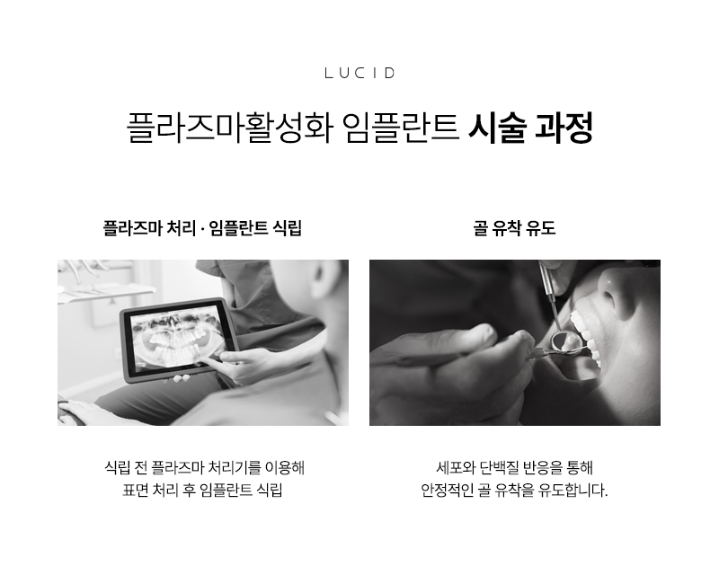 Why Plasma Implants Are Said to Recover Faster at Nonhyeon-dong Dental Clinic image 5