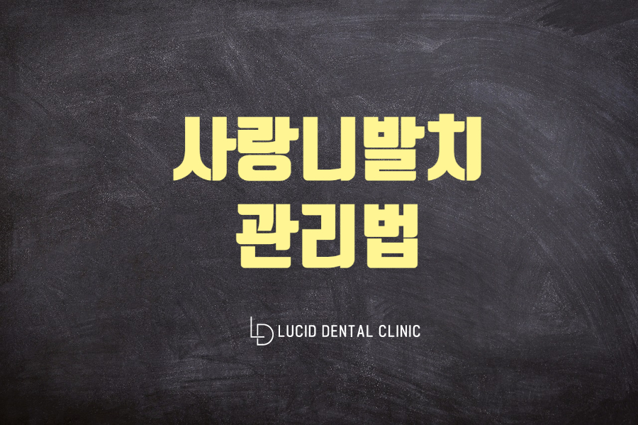 역삼역 사랑니발치 후 관리하는 방법은? 루시드 치과 관련 이미지 1