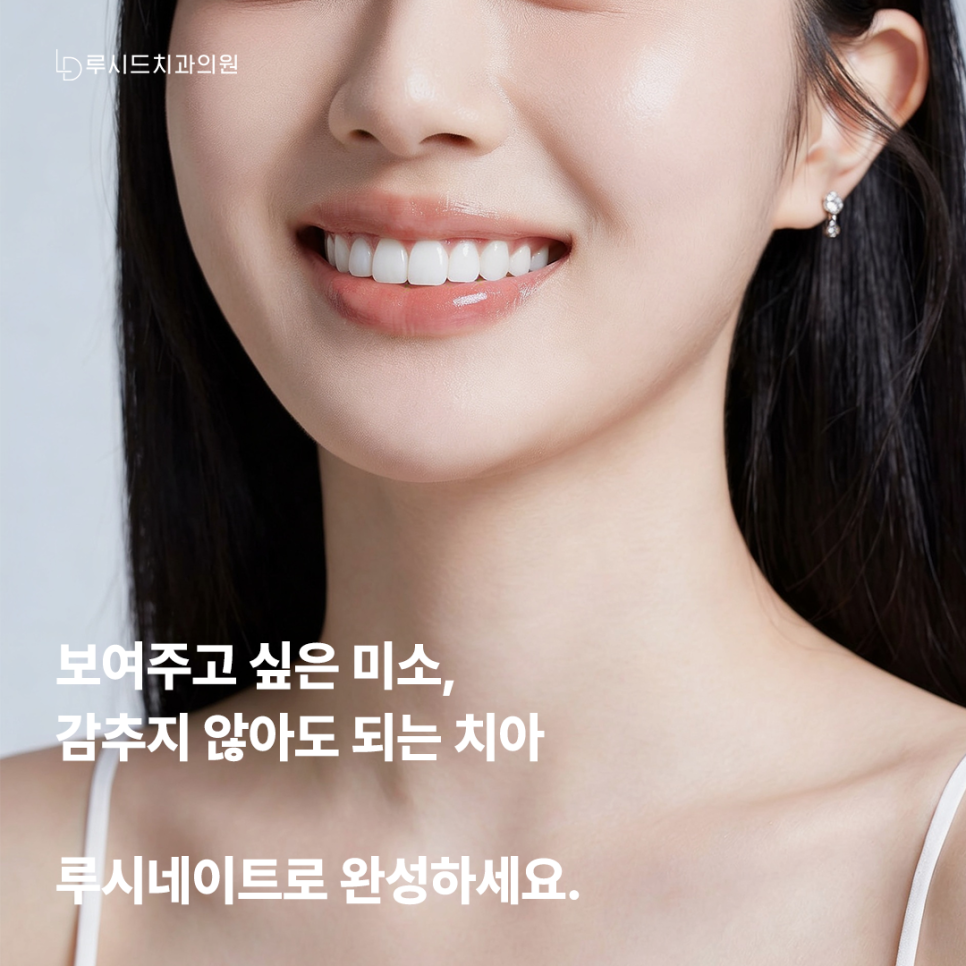 강남라미네이트 필요한 치아는 어떤 경우일까요? 관련 이미지 2