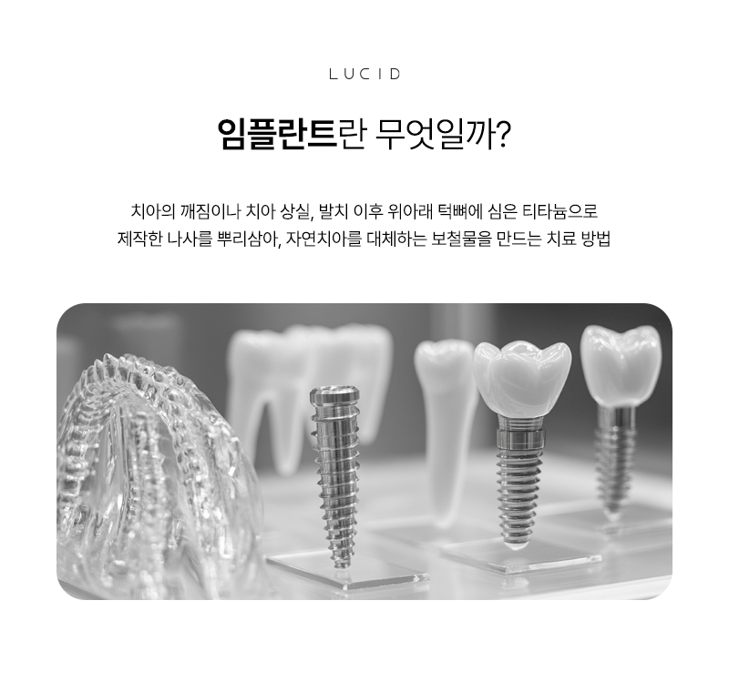 Where Should You Get an Implant Near Gangnam Station? image 3