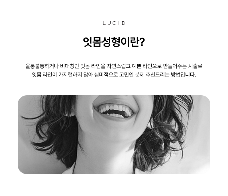 Gangnam dental clinic gum contouring: In what cases is it needed? image 3