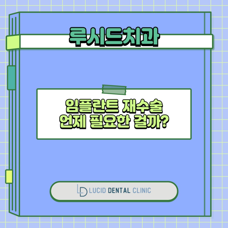 임플란트 재수술, 언제 필요한 걸까요? 원인부터 예방법까지 논현동 치과 가 알려드리겠습니다! 관련 이미지 4