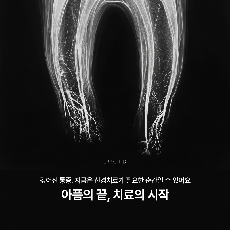 Nonhyeon-dong Dental Clinic Root Canal Treatment: Another Choice for Saving a Tooth image 2