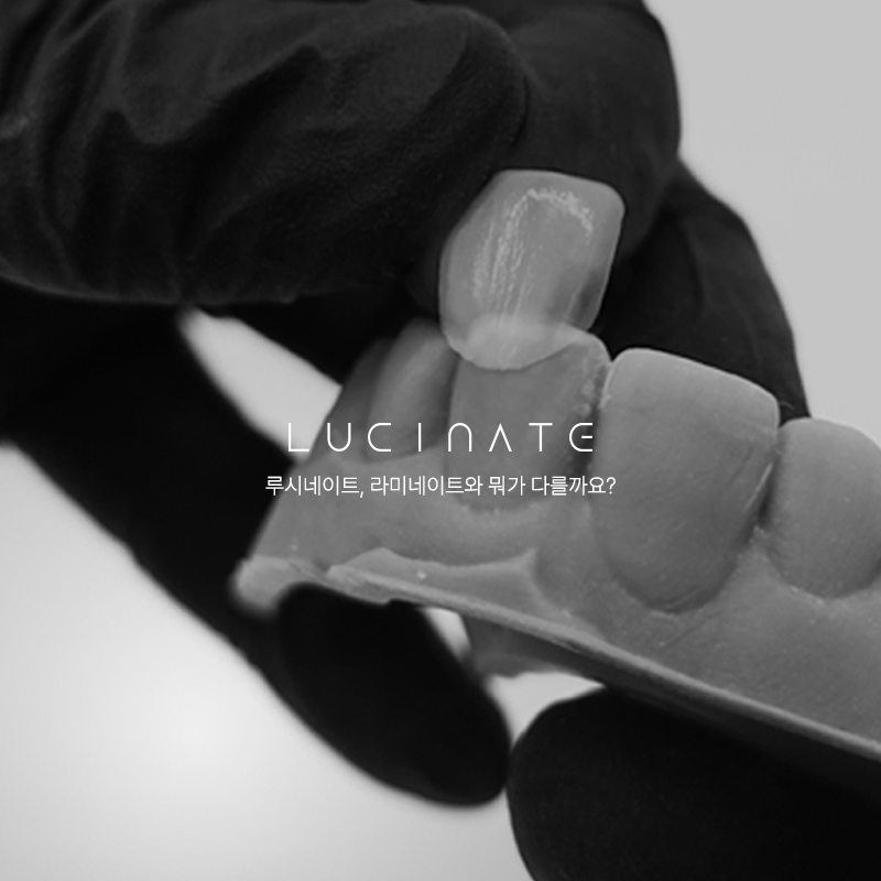 Lucinate, for Those Who Want a Natural Smile image 2