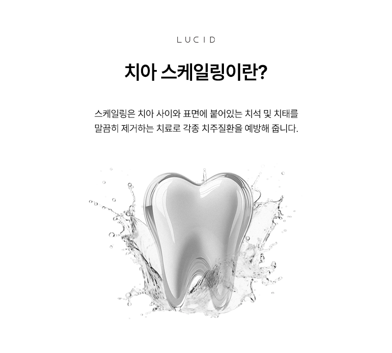 언주역치과 스케일링 잇몸병 예방에 왜 중요할까? 관련 이미지 2