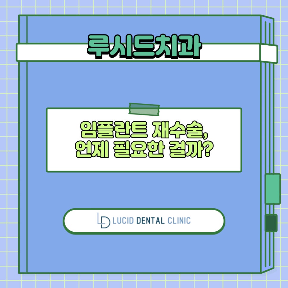 임플란트 재수술, 언제 필요한 걸까요? 원인부터 예방법까지 논현동 치과 가 알려드리겠습니다! 관련 이미지 1